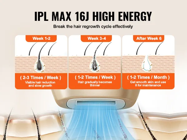 VEVOR IPL-ontharingsapparaat toont het haarverminderingsproces gedurende weken.